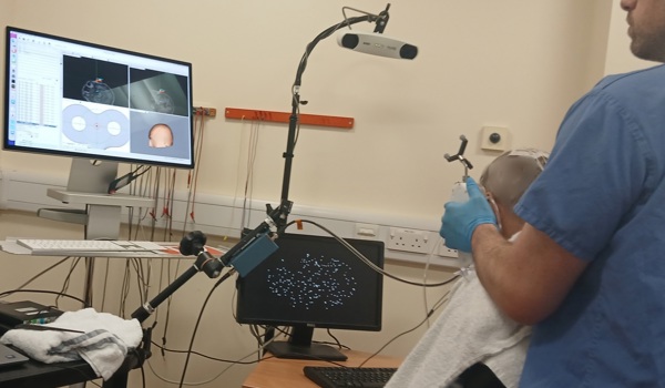 Study shows that non-invasive ultrasound shows promise for treating Parkinson’s disease