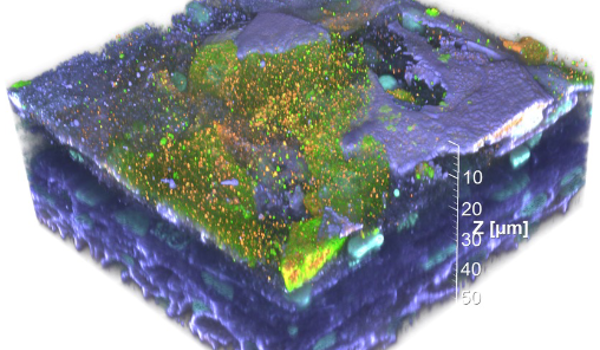 Micro-bladder model offers clues to stopping recurrent UTIs